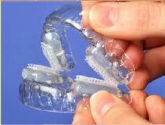 Snoring-Mouthpiece-Comfortable-or-Not-Snoring-Mouthpiece.jpg Snoring-Mouthpiece-Comfortable-or-Not-Snoring-Mouthpiece.jpg