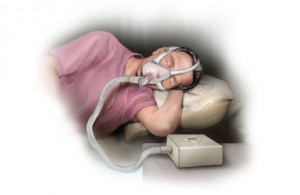 CPAP Machines And CPAP Masks