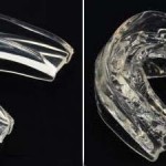 snoring mouthpiece before and after molding