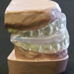 SnorBan Mouthpiece Reduces Snoring.jpg