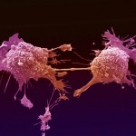 Does Snoring Cause Cancer