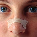 deviated septum