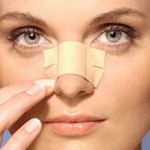 rhinoplasty