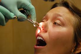 Septoplasty To Cure Snoring